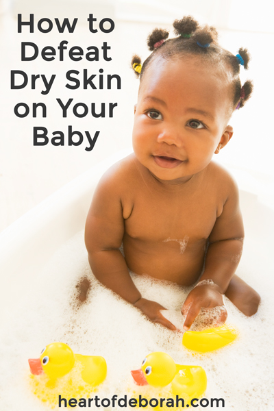 Is your baby prone to dry skin? How often should you be moisturizing? Read how to defeat dry skin and soothe your baby's skin with these 7 simple tips!